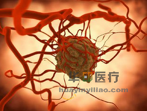 易瑞沙提高非小细胞肺癌患者的EGFR突变阳性患者生存