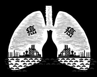 易瑞沙(吉非替尼)定制治疗晚期肺癌？