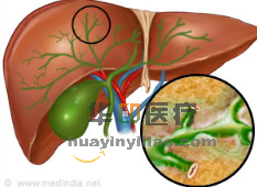 卡培他滨改善稀有癌症患者的生存率