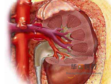 帕唑帕尼转移性非透明细胞型肾细胞癌