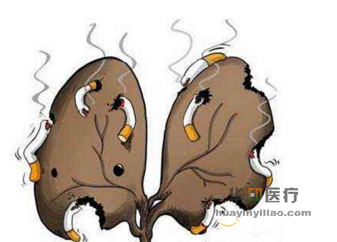 吸烟对特罗凯的影响