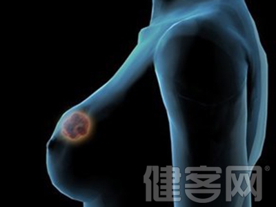 女性必须注意的9大乳房变化